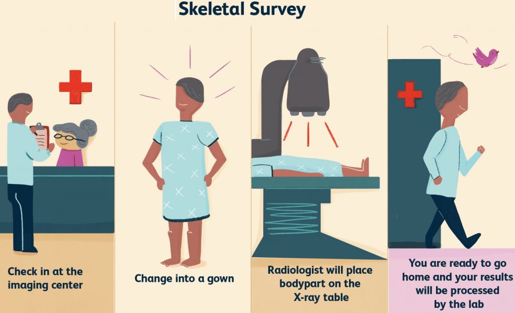 Skeletal Survey